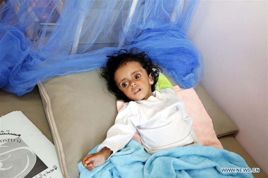 YEMEN-SANAA-FAMINE